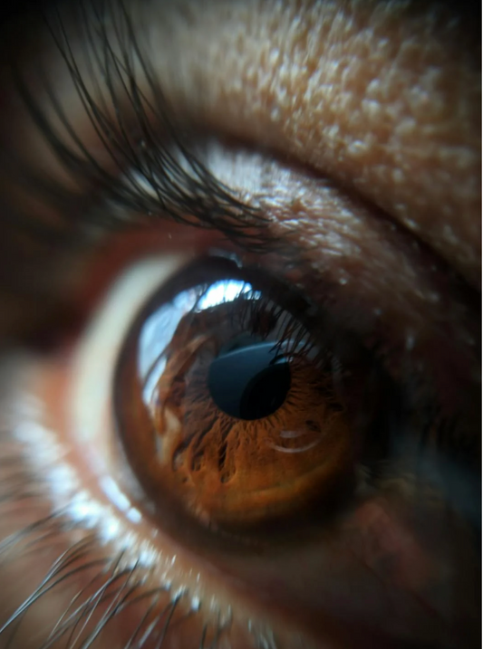 oeil marron focus
